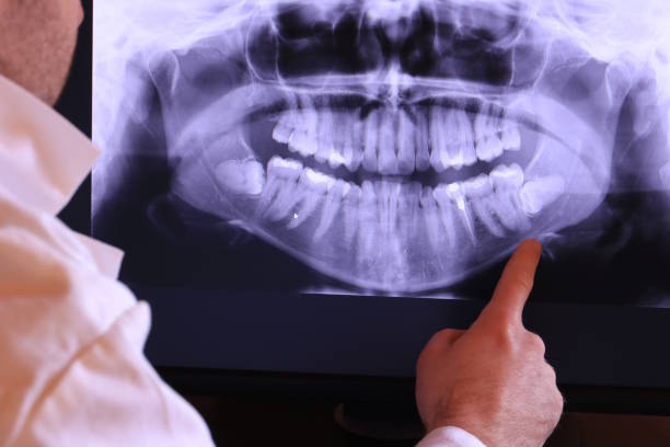 Urgent Tooth Repair in IL