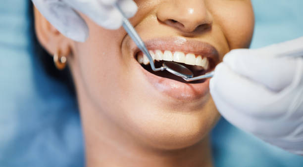 Best Knocked-Out Tooth Emergency  in Gman, IL