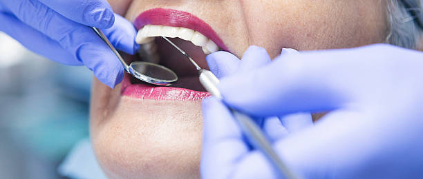 Best Emergency Dental Filling Replacement  in Gman, IL